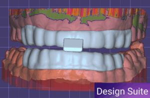 Design Suite: Anterior Discluder Lower Slider